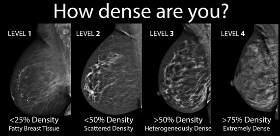 Loss of breast tissue reasons