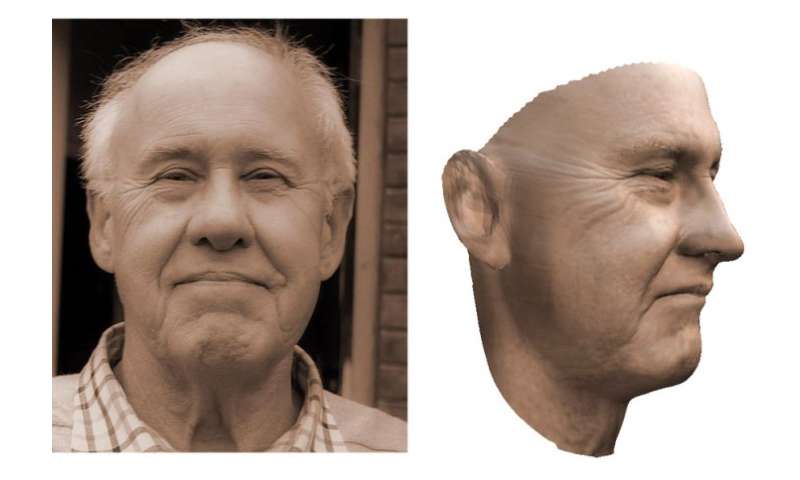 Facial paraylsis reconstructive fl