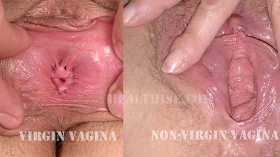 Virgin vagina look a like