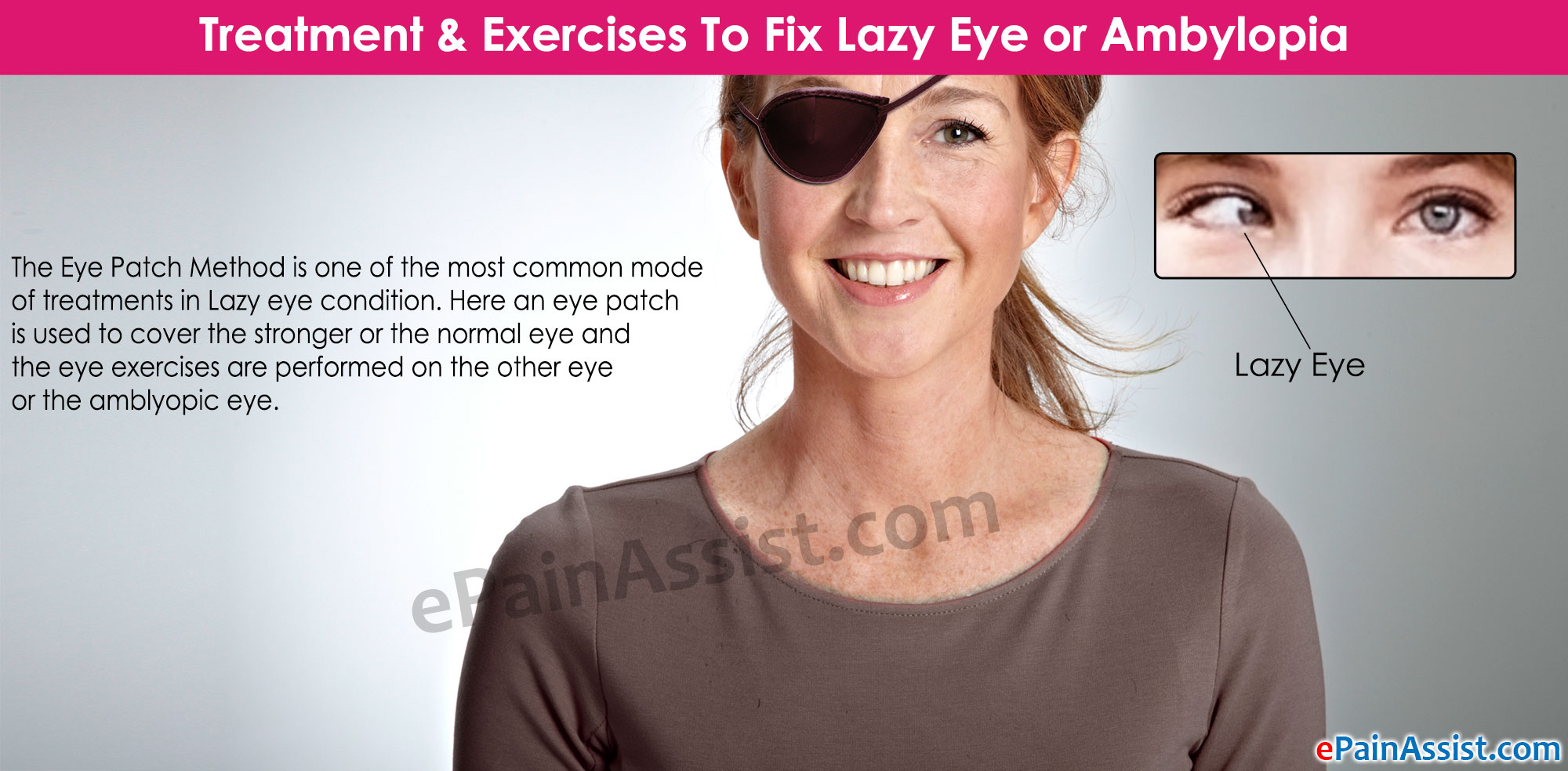 Adult eye lazy treatment