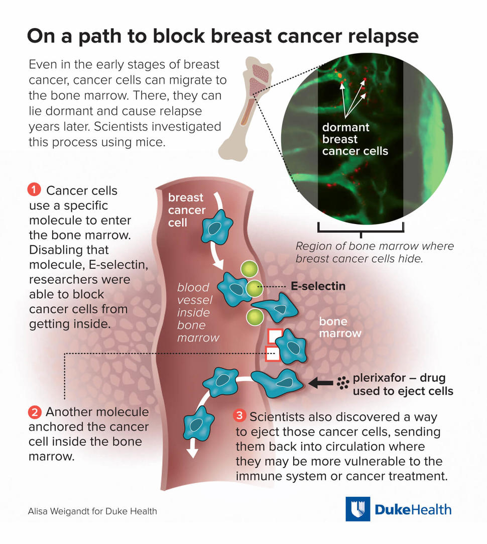 Bone metastases in breast cancer