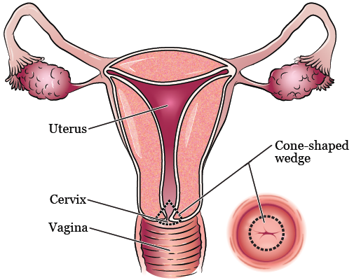 Sore lump inside vagina