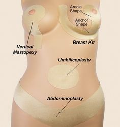 Breast reduction surgery scottsdale