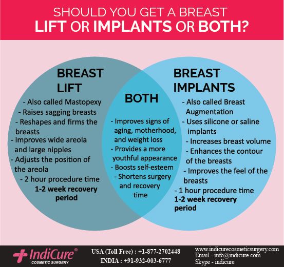 Breast esteem low implants self