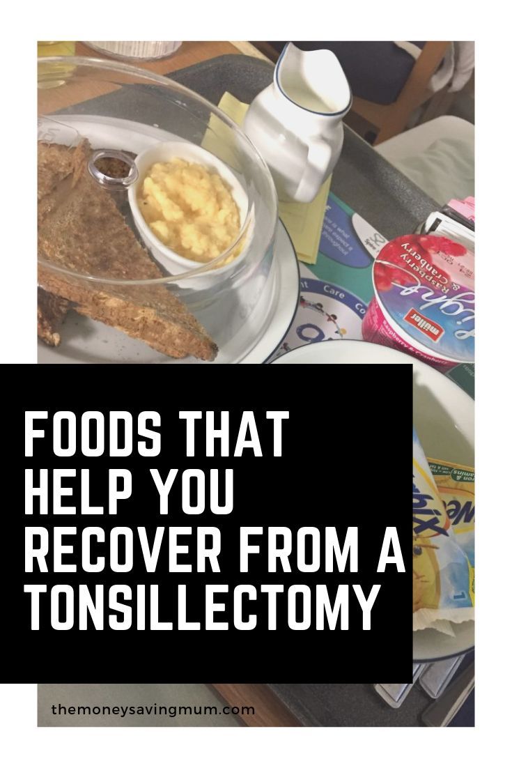 Support groups for adults of tonsillectomy